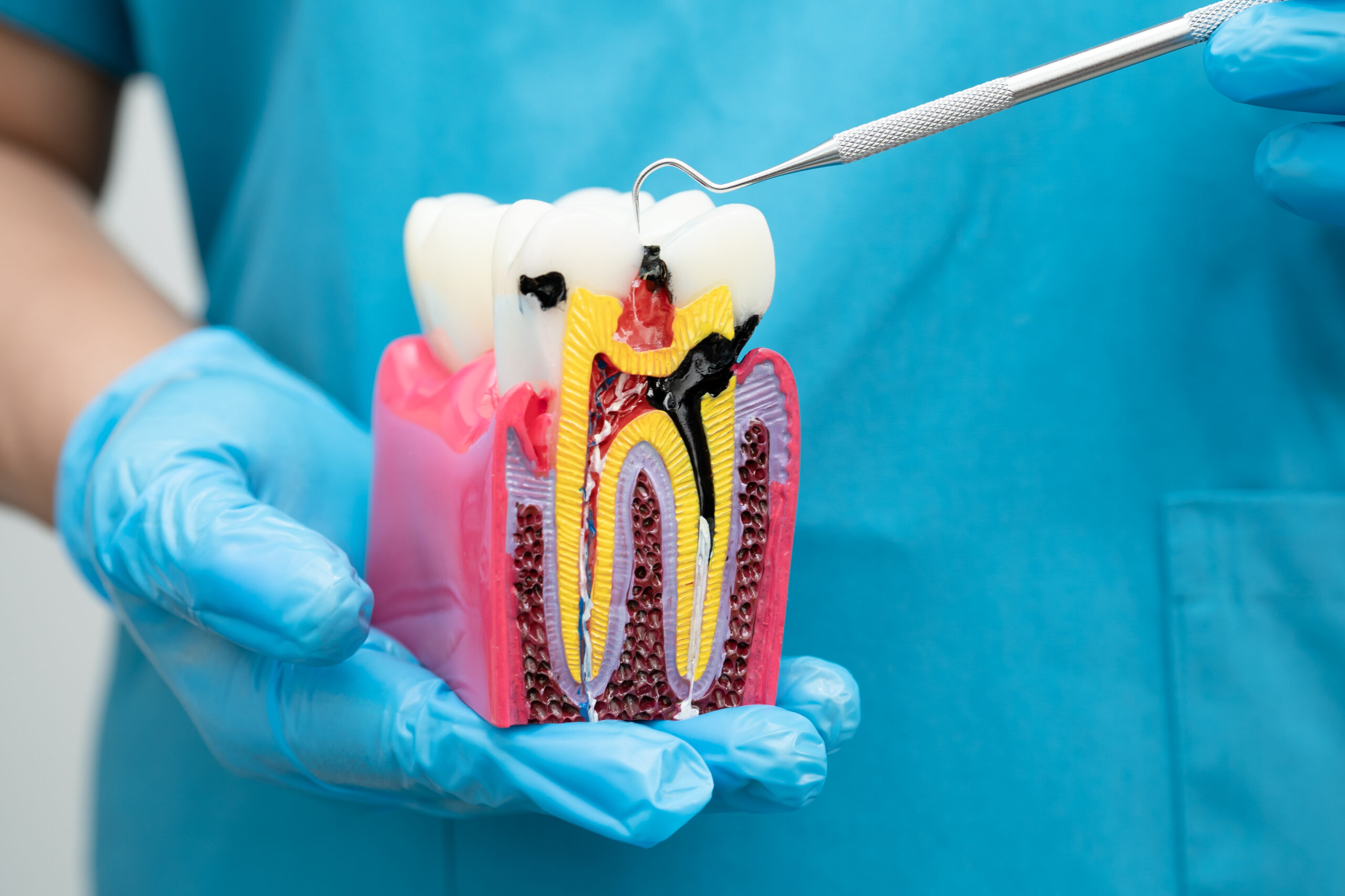 manage pain before, during, and after root canal