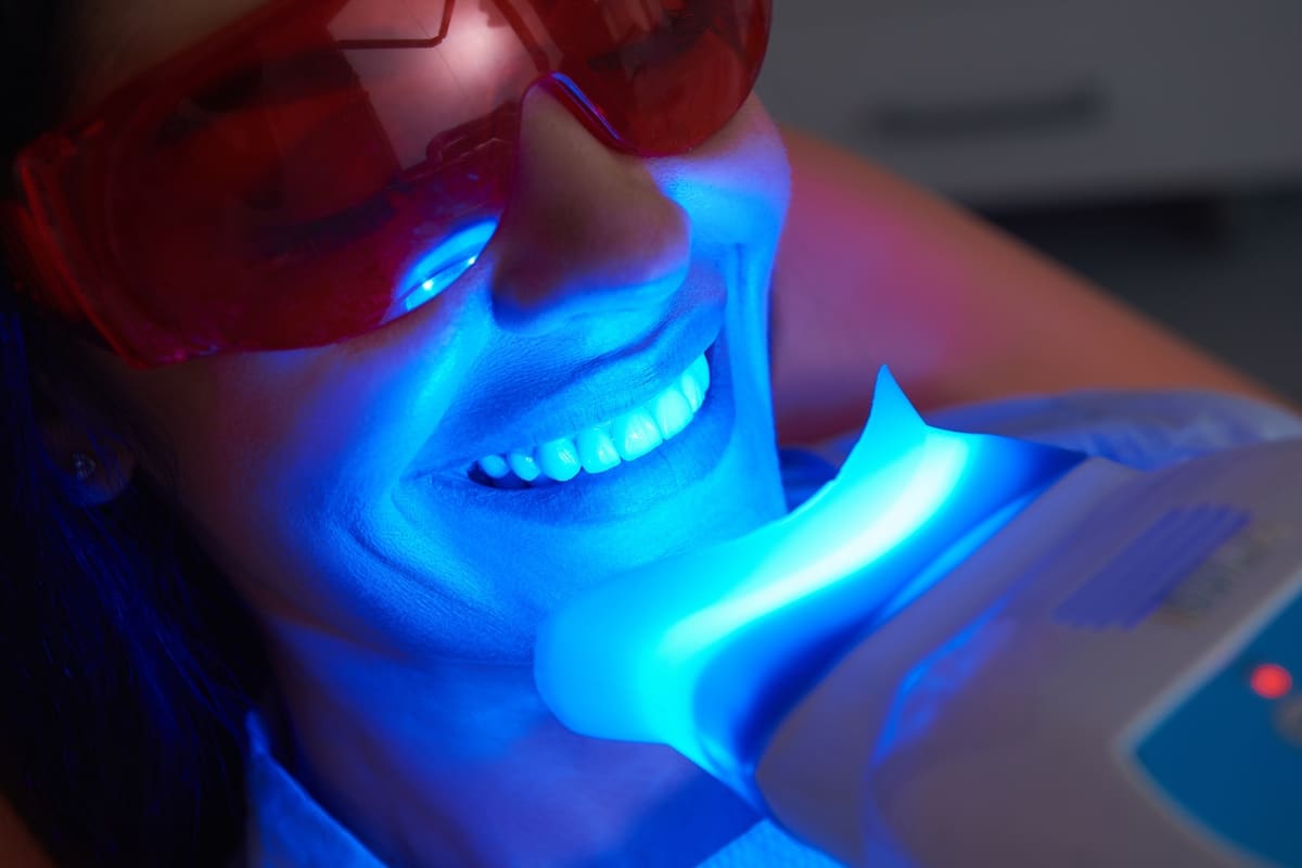 teeth-whitening-in-Long-Beach